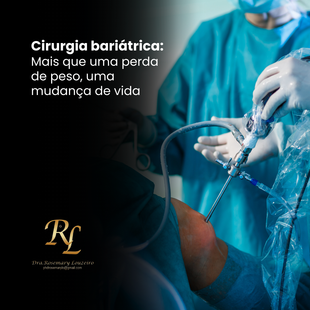 Você está visualizando atualmente Cirurgia bariátrica: Mais que uma perda de peso, uma mudança de vida