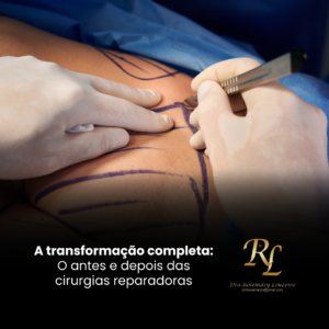 Leia mais sobre o artigo A transformação completa: O antes e depois das cirurgias reparadoras