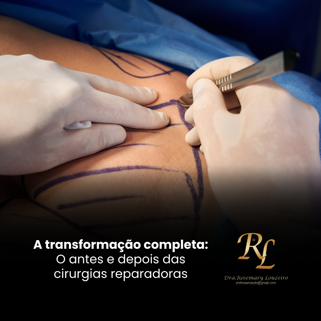 Você está visualizando atualmente A transformação completa: O antes e depois das cirurgias reparadoras
